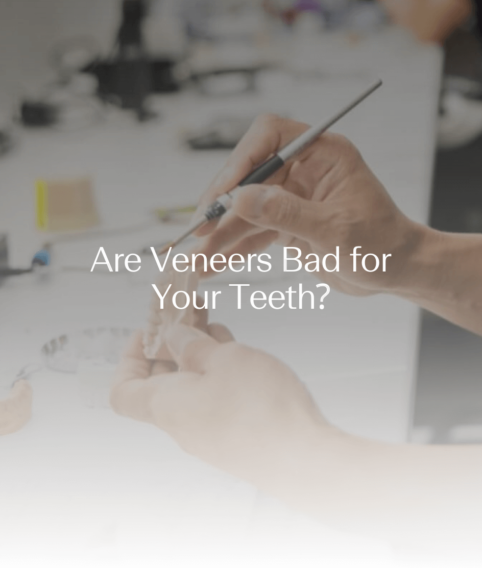 Are Veneers Bad for Your Teeth?