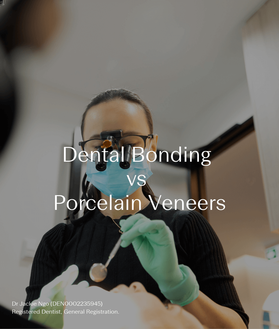 Dental Bonding vs Porcelain Veneers: Which Option Could Be Right for You?