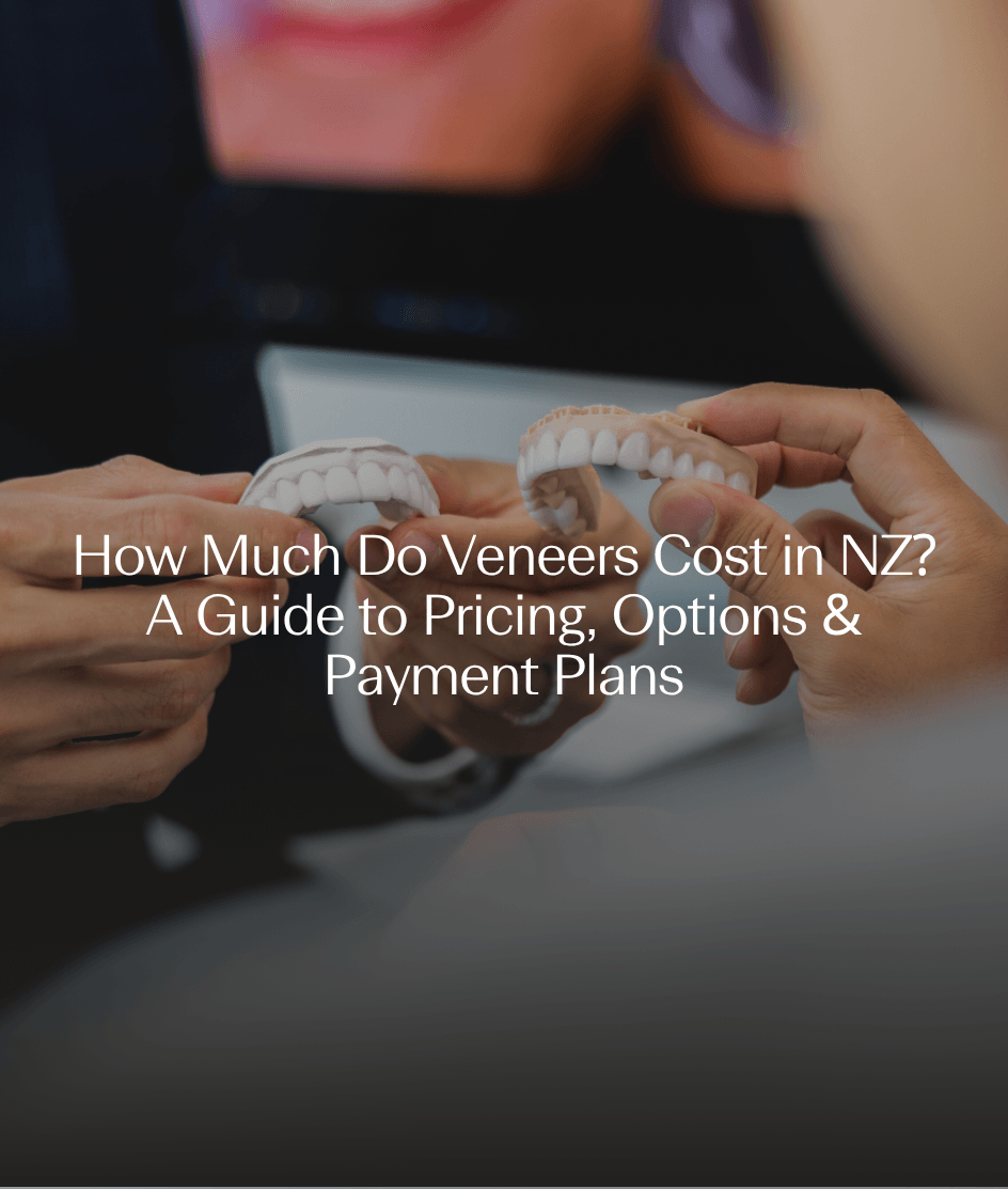 How Much Do Veneers Cost in NZ? A Guide to Pricing, Options & Payment Plans
